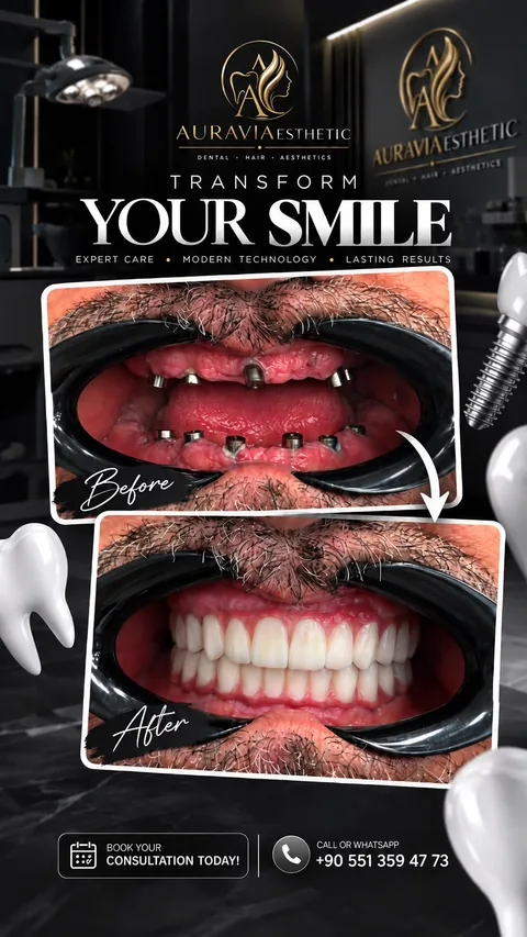 Implant restoration: before-and-after close-up