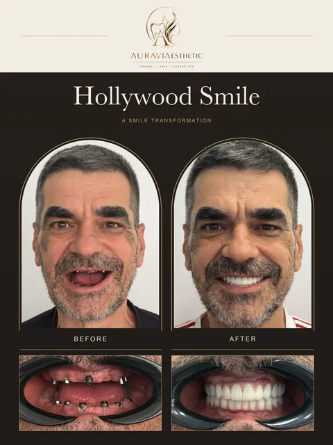 Smile case 01: before-and-after facial and dental photographs