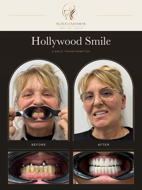 Smile case 02: before-and-after facial and dental photographs